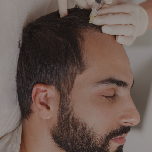 Zen Luxe Med Spa Aesthetic Services with Injector Resha A man with a beard getting a hair transplant.