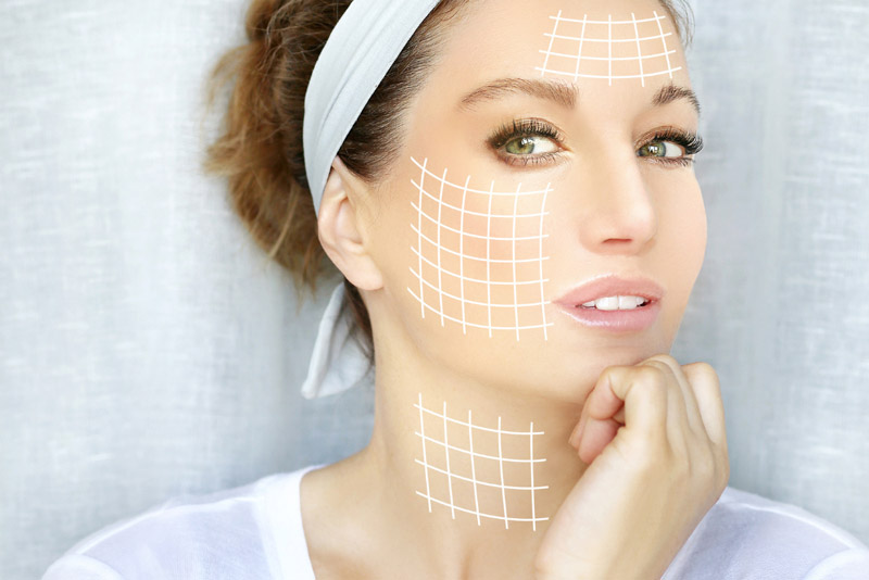 Woman marked for facial balancing with dermal fillers at Zen Luxe Medspa and IV Lounge Coral Springs FL