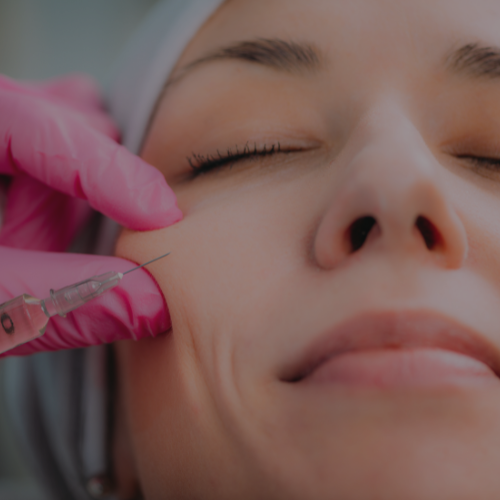 Dermal FIller Treatment at Zen Luxe Medspa and IV Lounge of Coral Springs, FL